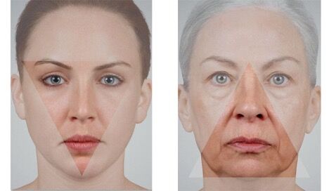 Restoring the Triangle of Youth in your face